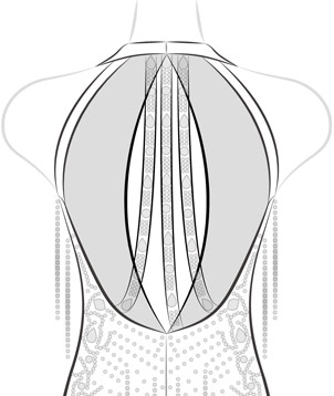 Keyhole Back