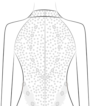 All Cover Back