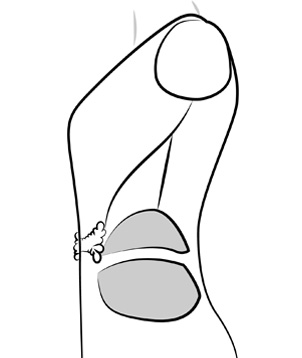 Add Side Covering