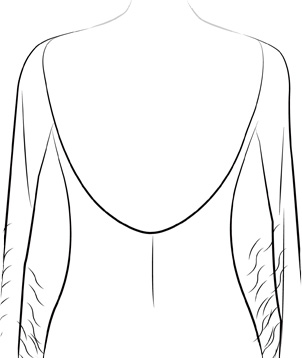 No Back Covering
