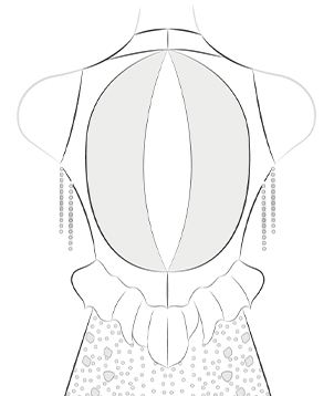 Keyhole Back