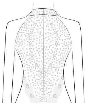 All Cover Back