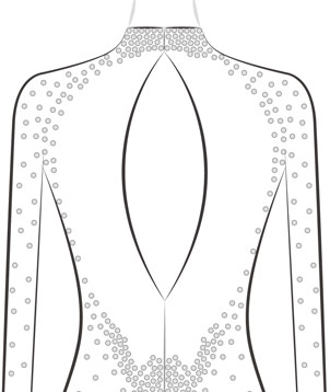 Keyhole Back