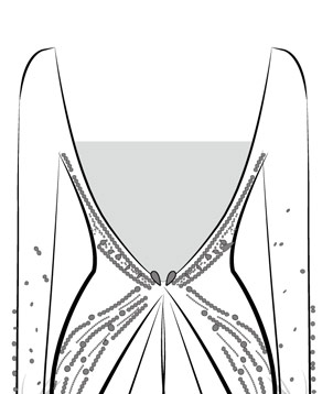 Add 1 Mesh Covering