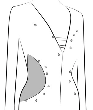 Add Side Covering