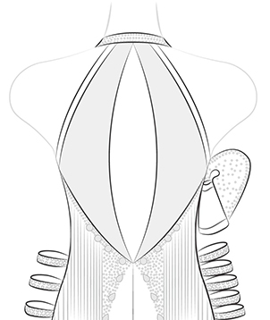 Keyhole Back