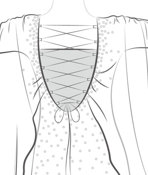 Add 1 Mesh Covering