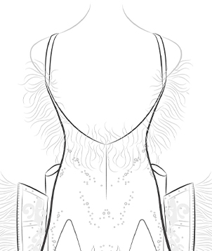 Backless