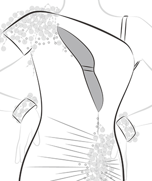 Add mesh covering