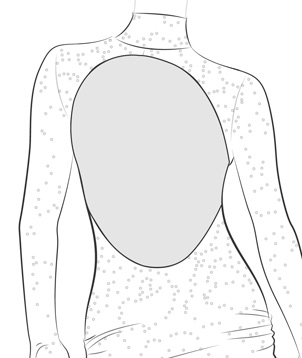Add 1 Mesh Covering