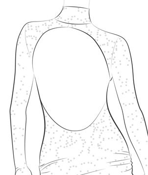 Keyhole Back