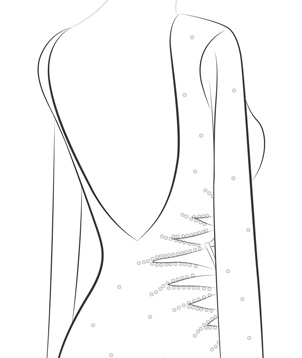 V Cut Back