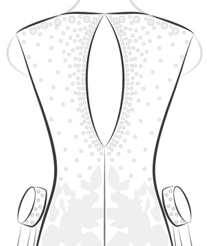 Keyhole Back