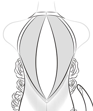 Keyhole Back