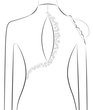 Keyhole Back