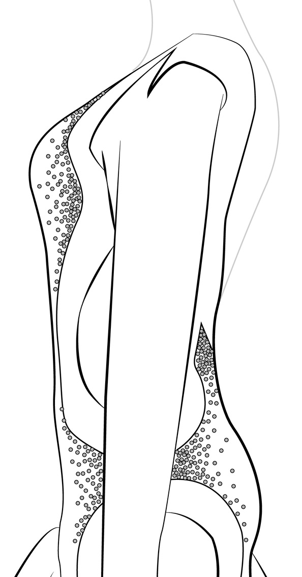 Rhinestone Color Img